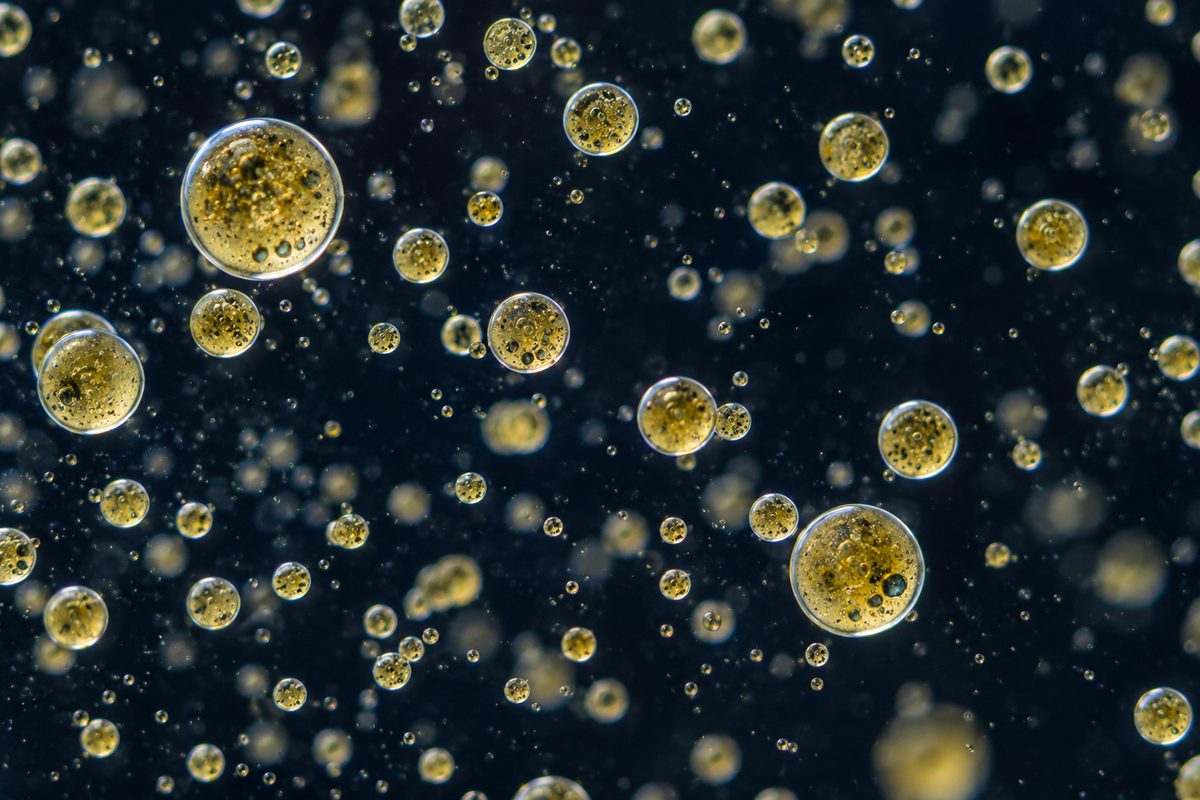 Darkfield microscopy analysis showing uniform sub-micron lipid emulsion dispersion